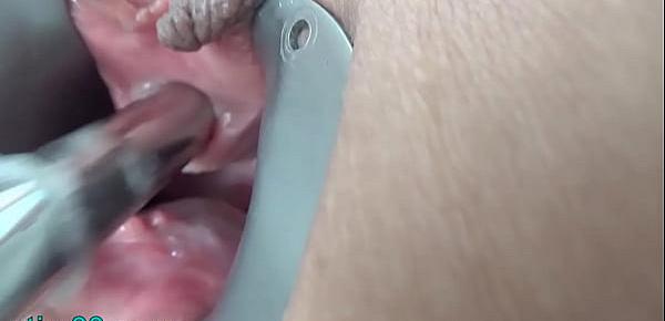  Peehole Play with Drilldo and Bladder filled with Cum and Piss